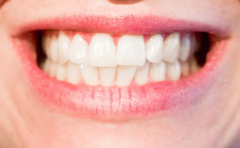 Aktualna technologia wykorzystywana w salonach stomatologii estetycznej zdoła sprawić, że odzyskamy śliczny uśmiech.